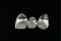 Preview: Bridge made of non-precious metal veneer, for a single tooth gap lower jaw visible area with partial ceramic veneer