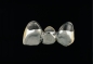 Preview: Gold veneer crown with partial ceramic veneer