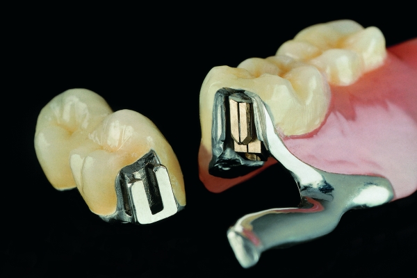Dentalshop24 Geschiebeprothese Dentalshop24 Geschiebeprothese